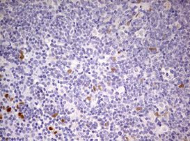 PRRX1 Antibody in Immunohistochemistry (Paraffin) (IHC (P))