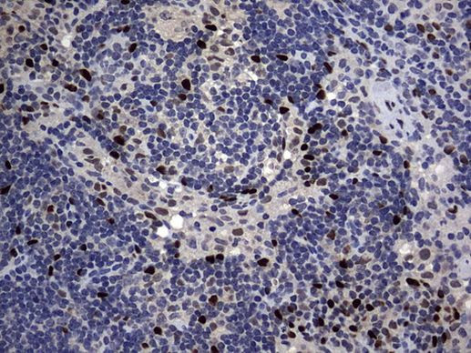 PRRX1 Antibody in Immunohistochemistry (Paraffin) (IHC (P))