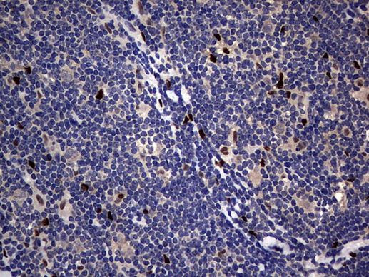 PRRX1 Antibody in Immunohistochemistry (Paraffin) (IHC (P))