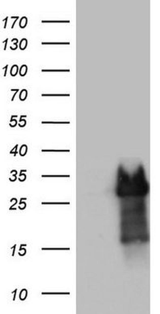 PRRX1 Antibody in Western Blot (WB)