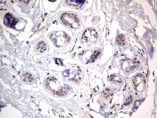 PRRX1 Antibody in Immunohistochemistry (Paraffin) (IHC (P))