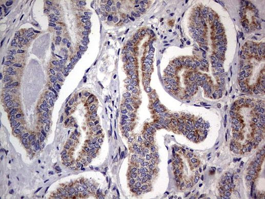 PRRX1 Antibody in Immunohistochemistry (Paraffin) (IHC (P))