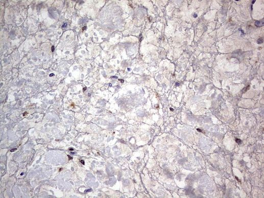 PRRX1 Antibody in Immunohistochemistry (Paraffin) (IHC (P))