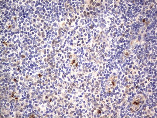 PRRX1 Antibody in Immunohistochemistry (Paraffin) (IHC (P))