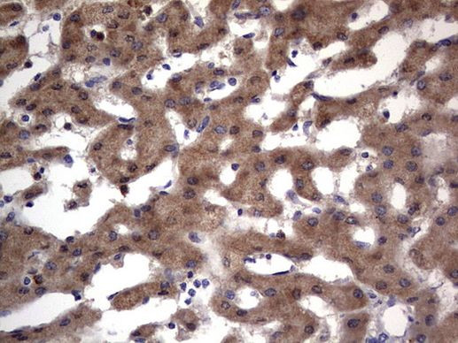 PRRX1 Antibody in Immunohistochemistry (Paraffin) (IHC (P))