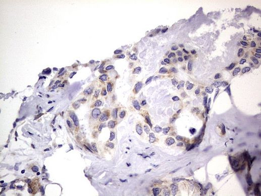 PRRX1 Antibody in Immunohistochemistry (Paraffin) (IHC (P))