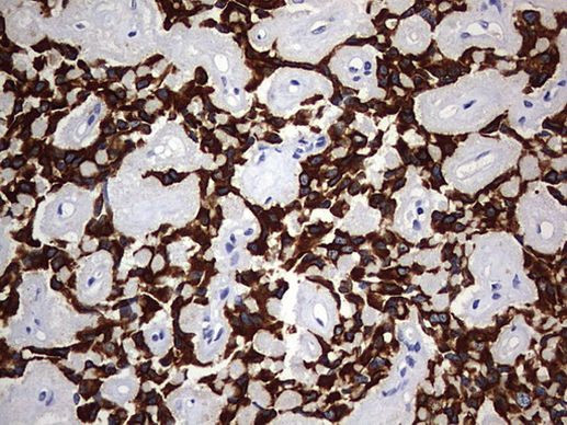 KRT24 Antibody in Immunohistochemistry (Paraffin) (IHC (P))