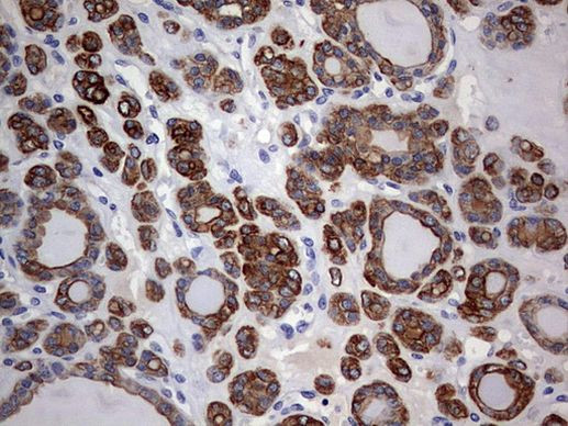 KRT24 Antibody in Immunohistochemistry (Paraffin) (IHC (P))