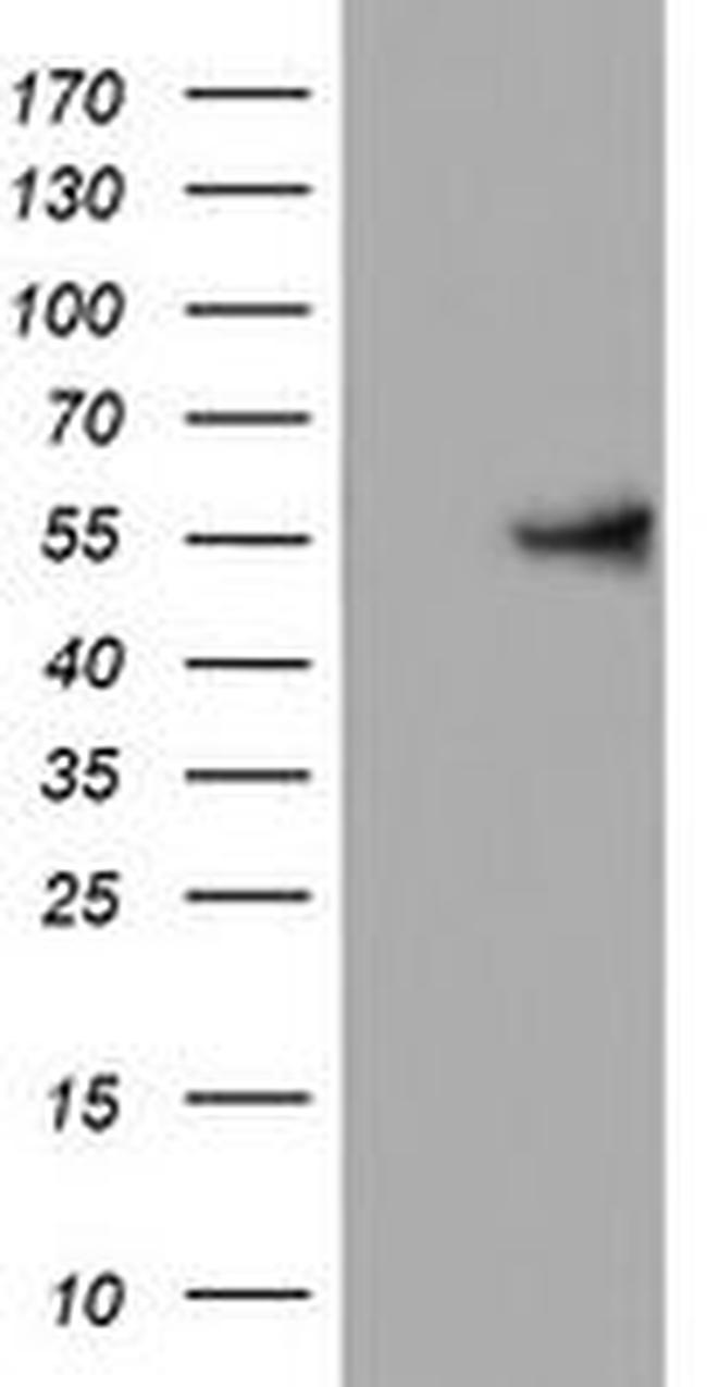 KRT24 Antibody in Western Blot (WB)