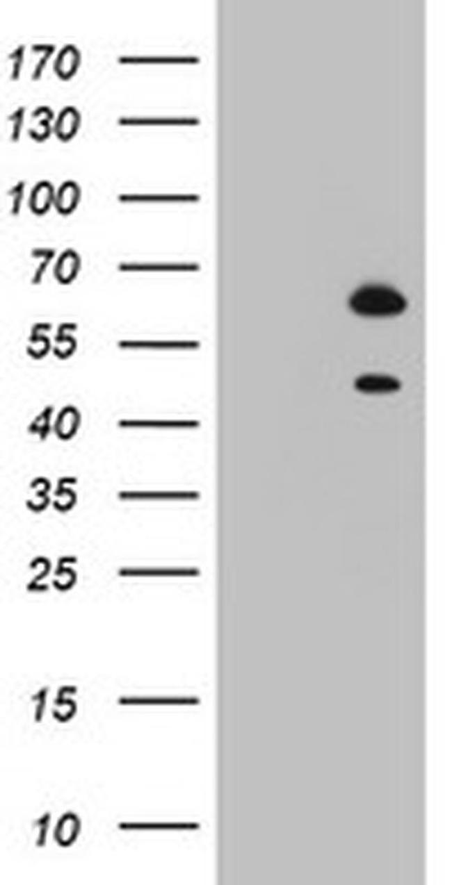 RBFOX1 Antibody in Western Blot (WB)