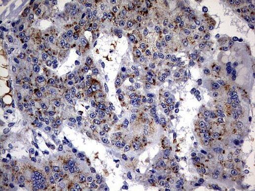 ABCD1 Antibody in Immunohistochemistry (Paraffin) (IHC (P))