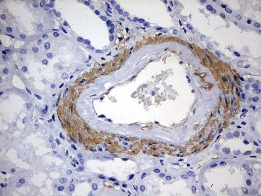 KLHL12 Antibody in Immunohistochemistry (Paraffin) (IHC (P))