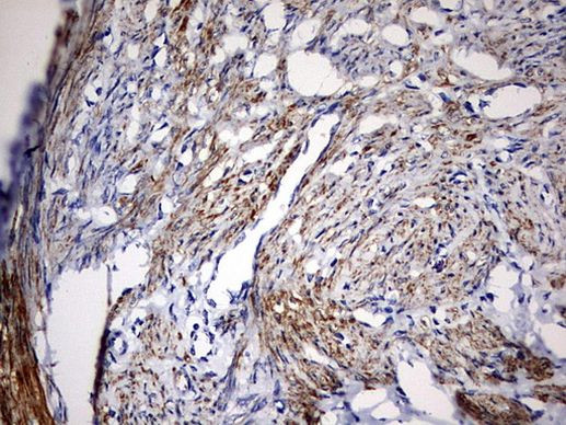 KLHL12 Antibody in Immunohistochemistry (Paraffin) (IHC (P))