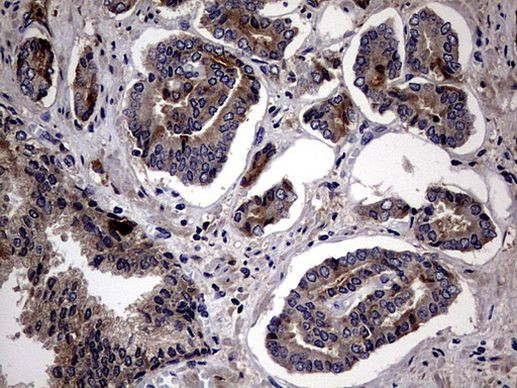 PLOD2 Antibody in Immunohistochemistry (Paraffin) (IHC (P))