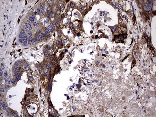 PLOD2 Antibody in Immunohistochemistry (Paraffin) (IHC (P))