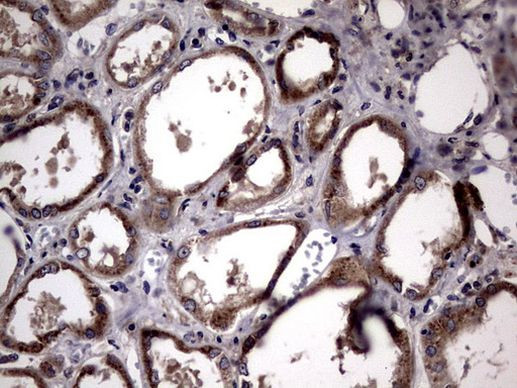 PLOD2 Antibody in Immunohistochemistry (Paraffin) (IHC (P))