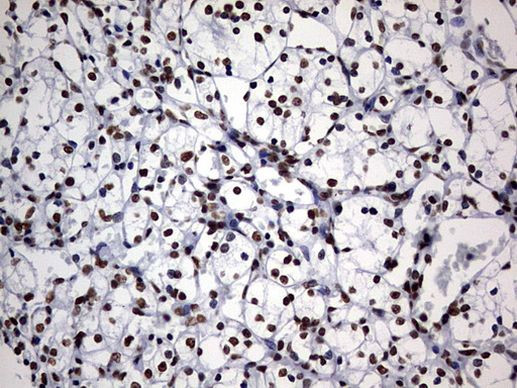 DDX56 Antibody in Immunohistochemistry (Paraffin) (IHC (P))