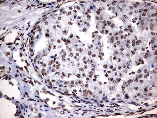 DDX56 Antibody in Immunohistochemistry (Paraffin) (IHC (P))