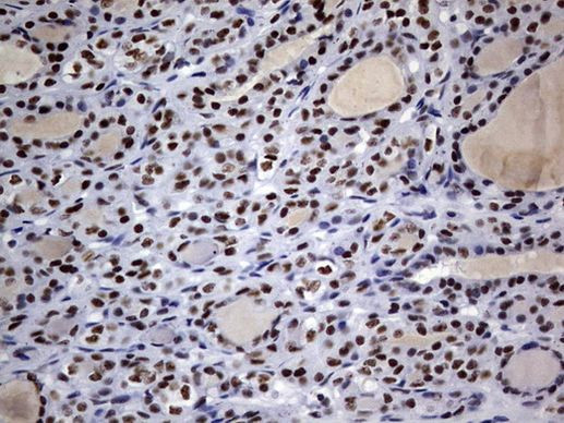 DDX56 Antibody in Immunohistochemistry (Paraffin) (IHC (P))