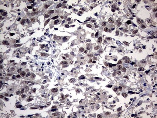 SAP30BP Antibody in Immunohistochemistry (Paraffin) (IHC (P))