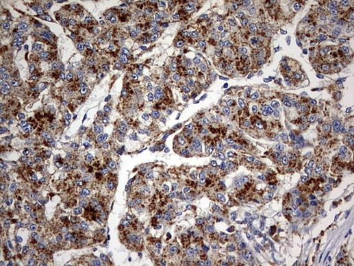 GBA Antibody in Immunohistochemistry (Paraffin) (IHC (P))