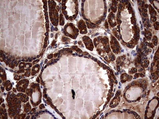 GBA Antibody in Immunohistochemistry (Paraffin) (IHC (P))