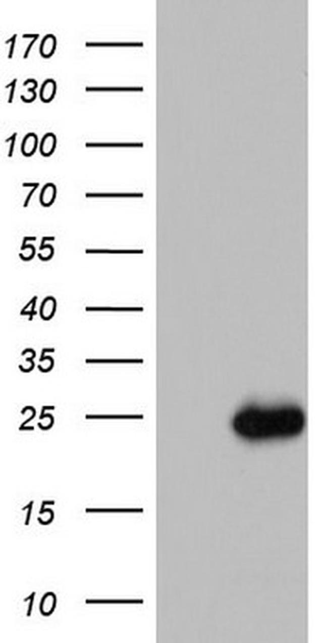 ISCU Antibody in Western Blot (WB)