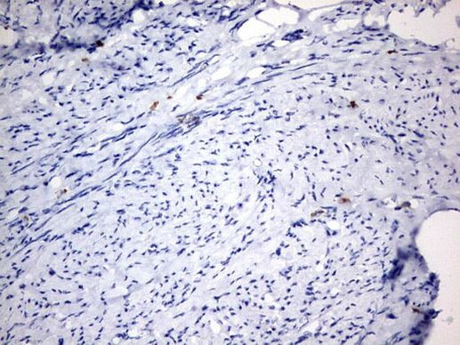 IL-20 Antibody in Immunohistochemistry (Paraffin) (IHC (P))