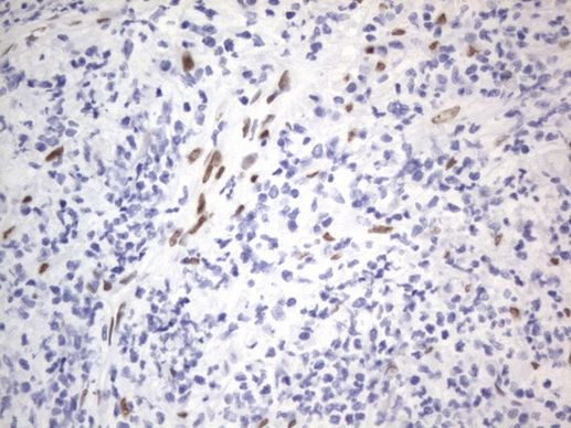 RBFOX1 Antibody in Immunohistochemistry (Paraffin) (IHC (P))