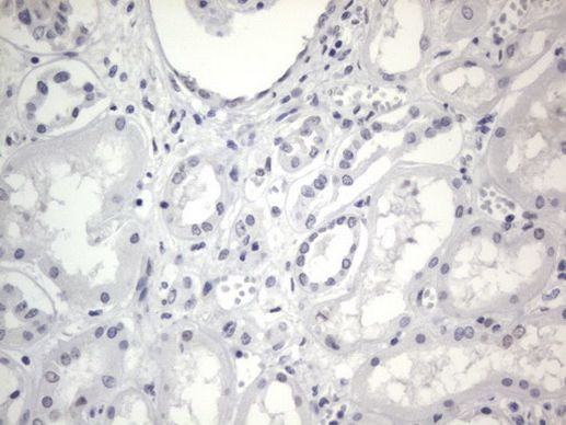 RBFOX1 Antibody in Immunohistochemistry (Paraffin) (IHC (P))