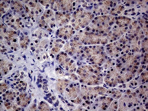 ABCD1 Antibody in Immunohistochemistry (Paraffin) (IHC (P))