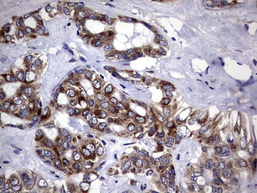 DDOST Antibody in Immunohistochemistry (Paraffin) (IHC (P))