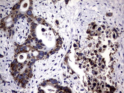 DDOST Antibody in Immunohistochemistry (Paraffin) (IHC (P))