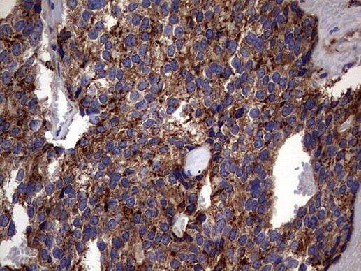 PDE1A Antibody in Immunohistochemistry (Paraffin) (IHC (P))