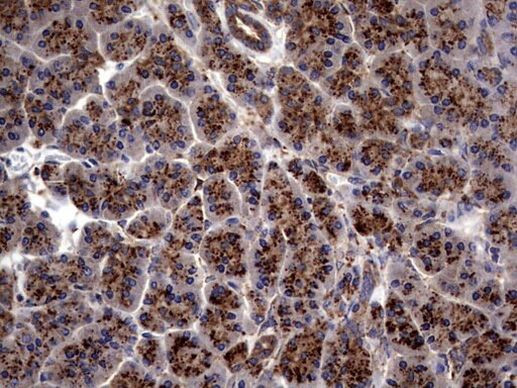 PDE1A Antibody in Immunohistochemistry (Paraffin) (IHC (P))