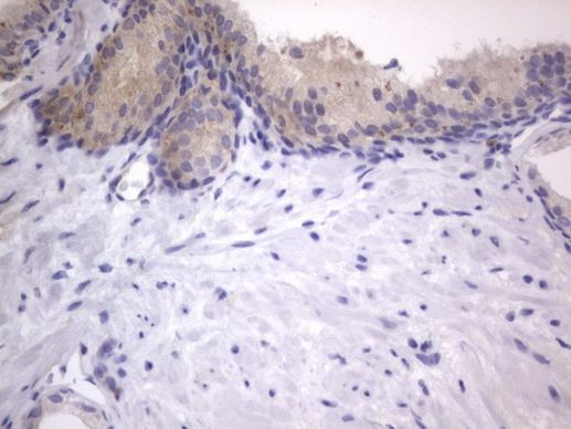 A-Raf Antibody in Immunohistochemistry (Paraffin) (IHC (P))