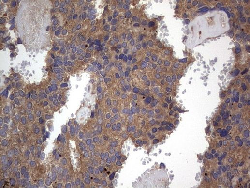 A-Raf Antibody in Immunohistochemistry (Paraffin) (IHC (P))