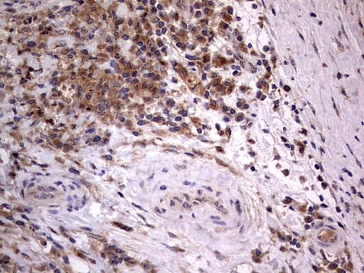 A-Raf Antibody in Immunohistochemistry (Paraffin) (IHC (P))