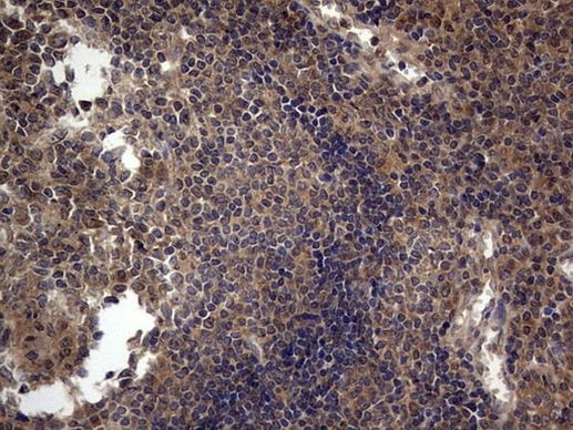 A-Raf Antibody in Immunohistochemistry (Paraffin) (IHC (P))