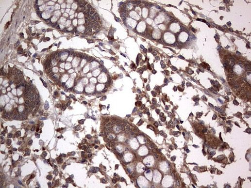 A-Raf Antibody in Immunohistochemistry (Paraffin) (IHC (P))