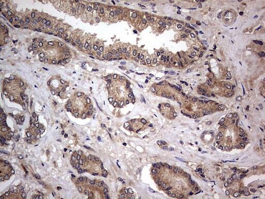 A-Raf Antibody in Immunohistochemistry (Paraffin) (IHC (P))