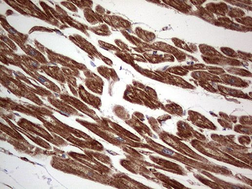 TACC2 Antibody in Immunohistochemistry (Paraffin) (IHC (P))