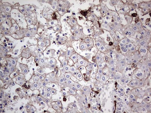 TACC2 Antibody in Immunohistochemistry (Paraffin) (IHC (P))