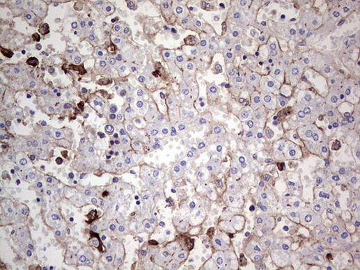 TACC2 Antibody in Immunohistochemistry (Paraffin) (IHC (P))