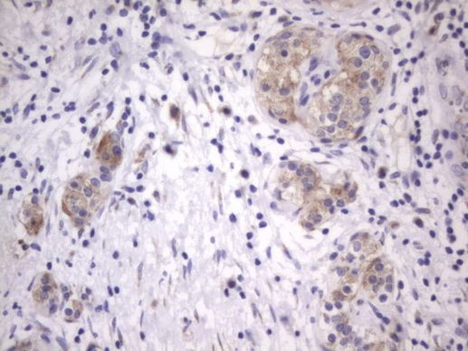 ITGB1BP1 Antibody in Immunohistochemistry (Paraffin) (IHC (P))