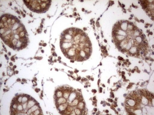 IGSF11 Antibody in Immunohistochemistry (Paraffin) (IHC (P))