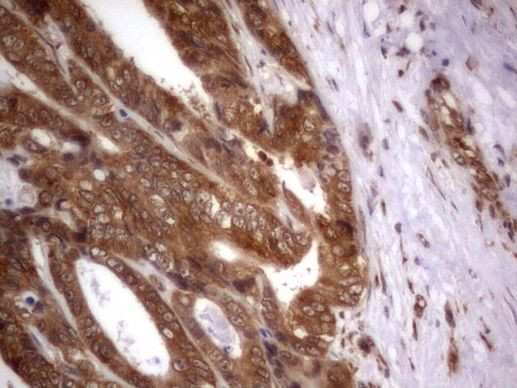 IGSF11 Antibody in Immunohistochemistry (Paraffin) (IHC (P))