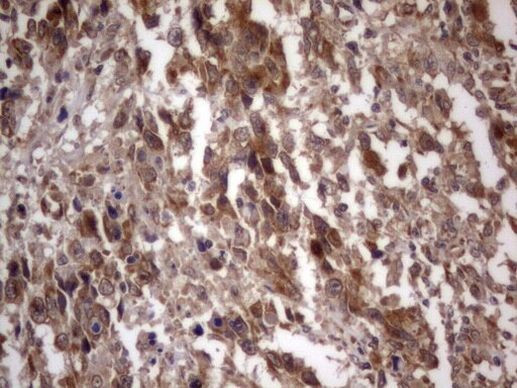 IGSF11 Antibody in Immunohistochemistry (Paraffin) (IHC (P))