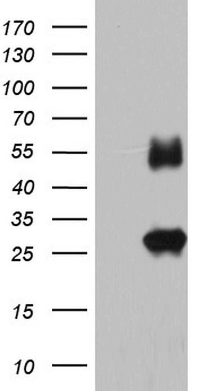 IGSF11 Antibody in Western Blot (WB)