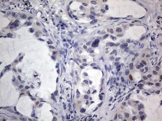 IGSF11 Antibody in Immunohistochemistry (Paraffin) (IHC (P))